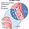 Larynx Cancer Symptoms