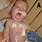 Noonan Syndrome Infant