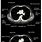 Normal Chest CT Anatomy