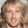Owen Wilson Nose Before and After