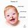 Pictures of Trisomy 13