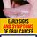 Signs of Oral Cancer On Tongue