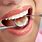 Teeth Procedures