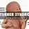 Turner Syndrome Newborn
