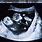 Twin Babies Ultrasound