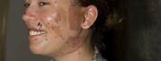 Us Military Dueling Scars
