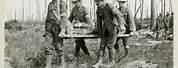 World War 1 Wounded Soldiers