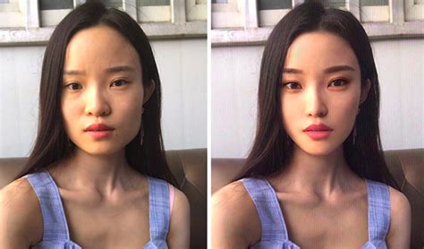 Chinese Actress Plastic Surgery