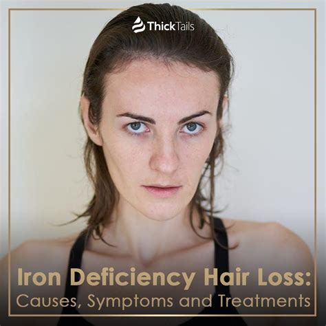 Iron Deficiency Hair Loss