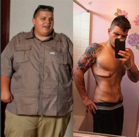 Obese Weight Loss Before And After