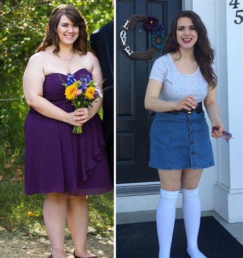 People Before And After Weight Loss