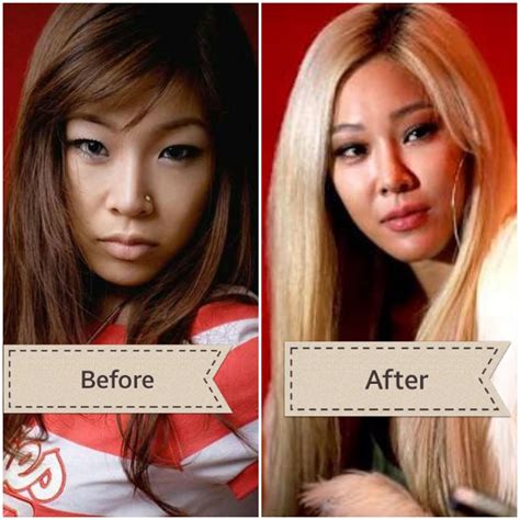 Plastic Surgery Before And After Hot