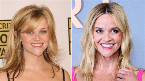 Reese Witherspoon After Surgery